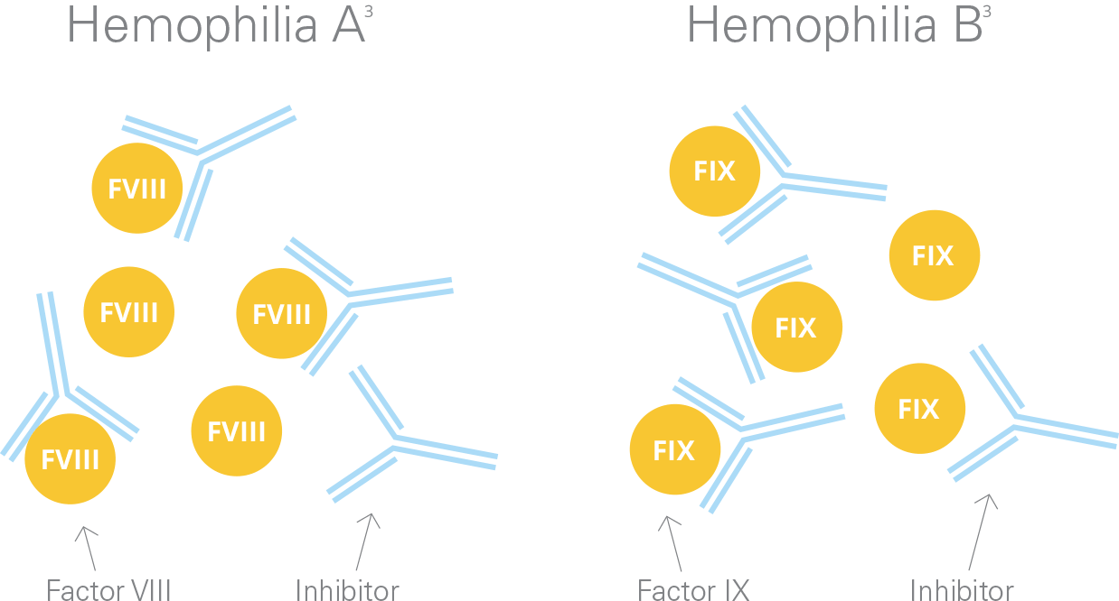 患有血友病A或B的人会产生抑制剂，从而阻止他们的VIII或IX因子治疗有效地形成凝块来止血