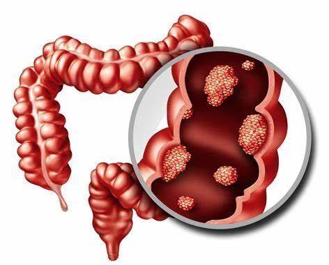 Modufolin(arfolitixorin)