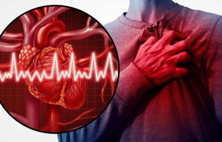 靶向炎性巨噬细胞可能有助于治疗和预防心房颤动