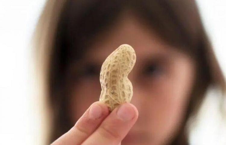 儿童花生过敏