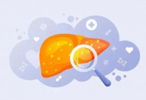 非酒精性脂肪性肝炎