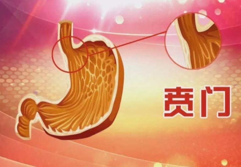 贲门癌(食管胃结合部癌)能治好吗,早期症状,如何治疗