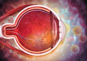ADX-2191治疗视网膜色素变性