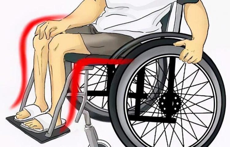 肌萎缩侧索硬化症