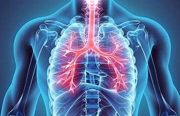 间质性肺病相关肺动脉高压