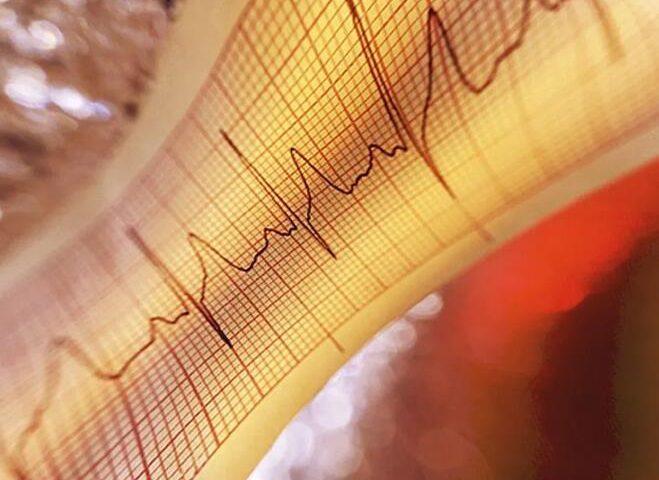 速效鼻喷雾剂可缓解心跳加速