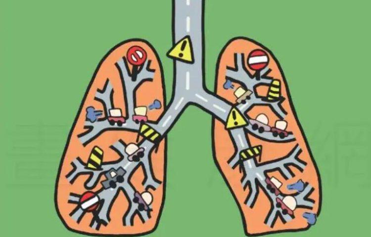 慢性阻塞性肺疾病