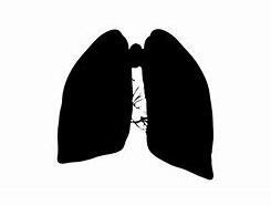 呼吸道乳头状瘤病