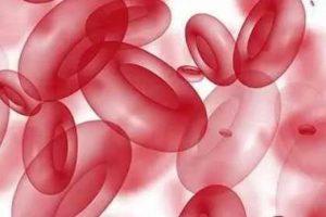 阵发性睡眠性血红蛋白尿症