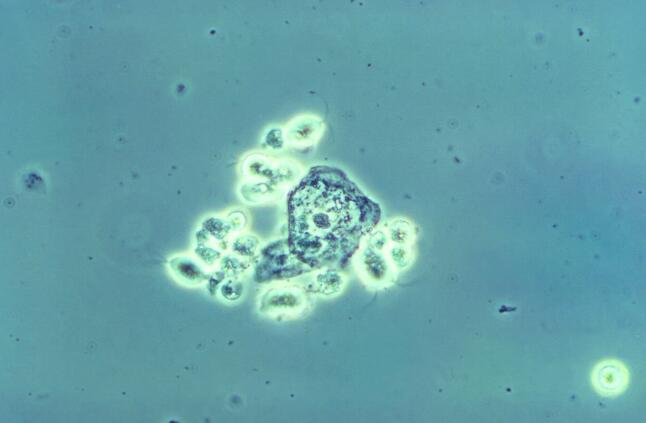FDA批准Likmez(ATI-1501)甲硝唑口服混悬剂