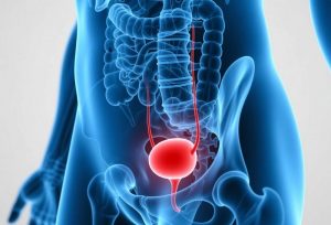 URO膀胱控制胶囊