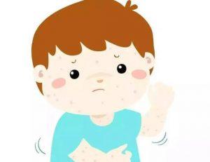 大疱性表皮松解症