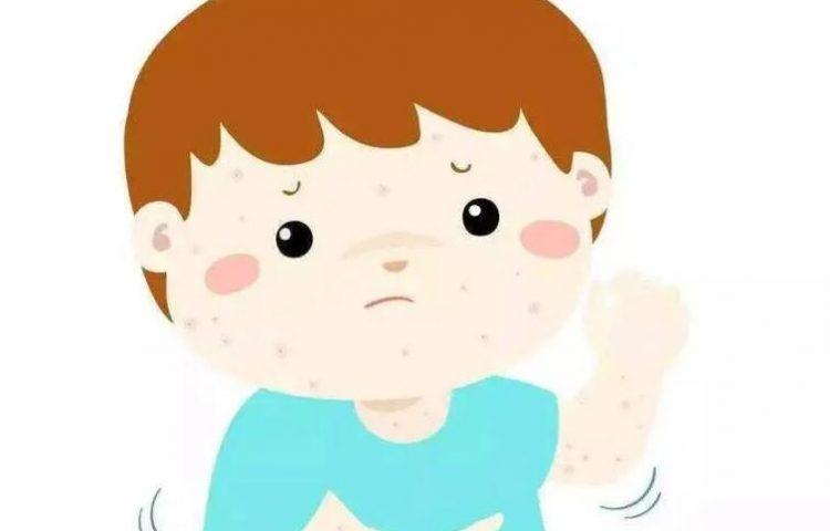 大疱性表皮松解症