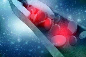 Olezarsen降低血液中的甘油三酯水平