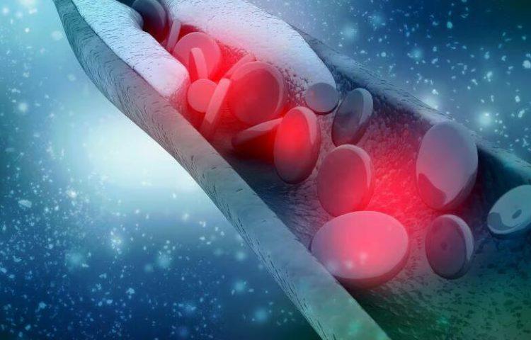 Olezarsen降低血液中的甘油三酯水平