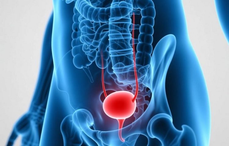 膀胱过度活动综合征