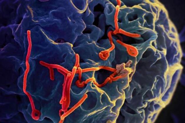 苏丹埃博拉病毒