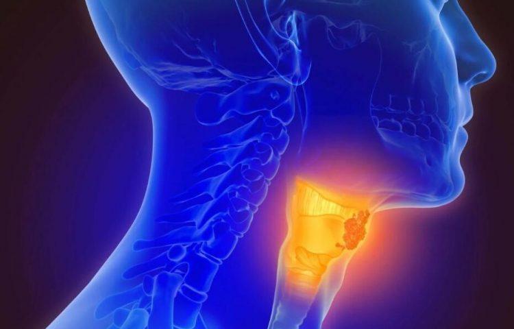 头颈部鳞状细胞癌