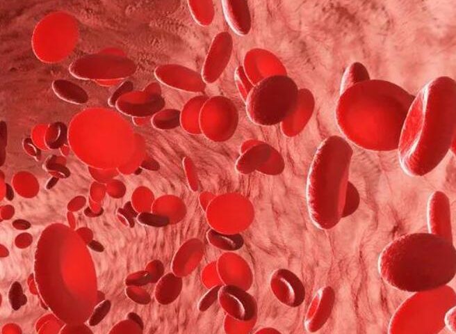 骨髓增生异常综合症