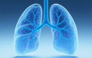 非囊性纤维化支气管扩张症