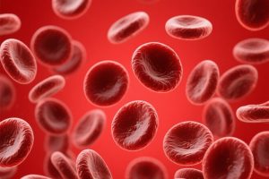 骨髓增生异常综合征