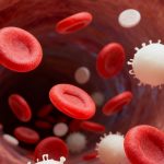 皮肤鳞状细胞癌