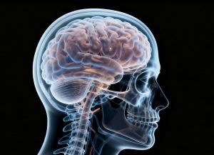 Friedreich共济失调症