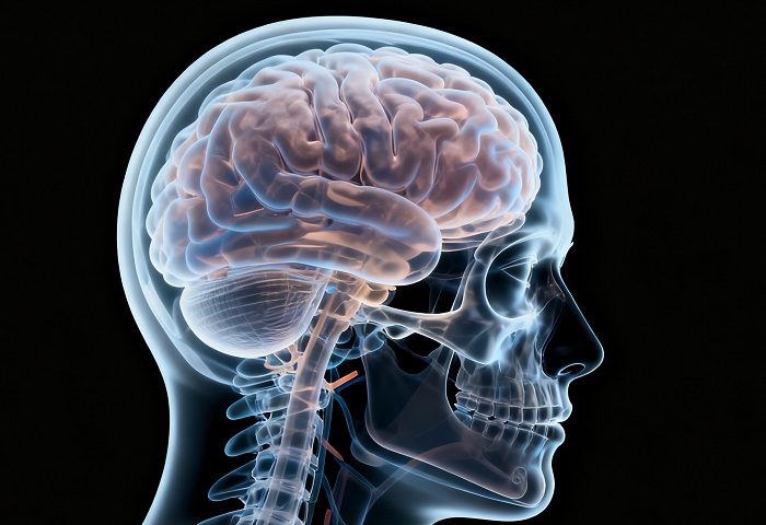 Friedreich共济失调症