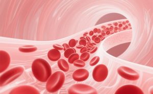 真性红细胞增多症