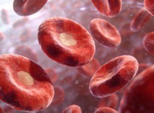 温型自身免疫性溶血性贫血