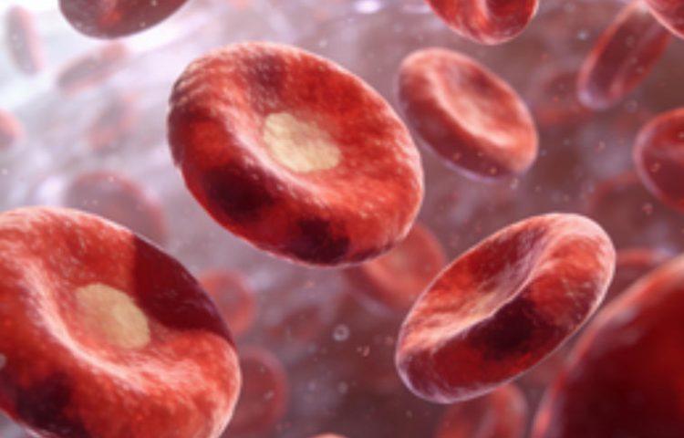 温型自身免疫性溶血性贫血