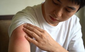 泛发性脓疱型银屑病